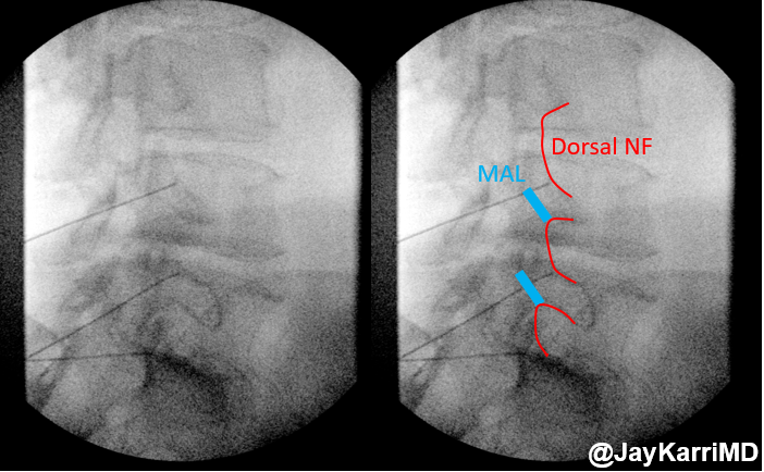 Jay Karri, MD, MPH tweet media