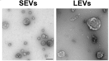 Vanderbilt Cell Imaging Shared Resource (@vucellimaging) on Twitter photo New publication from Dr. Alyssa Weaver's lab <a href="/AWeaverLab/">A Weaver Lab</a> with beautiful EV imaging. Check out all the Electron Microscopy with CISR-EM Manager Dr. Evan Krystofiak as co-author. Scale bar = 200 nm. New publication from Dr. Alyssa Weaver's lab <a href="/AWeaverLab/">A Weaver Lab</a> with beautiful EV imaging. Check out all the Electron Microscopy with CISR-EM Manager Dr. Evan Krystofiak as co-author. Scale bar = 200 nm.