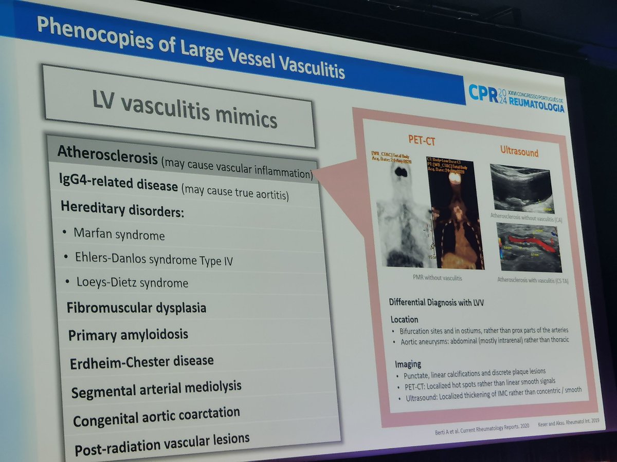 vitortexas's tweet photo. When to suspect large and medium vasculitis mimics. Excellent review from @cristinadbponte.
@LPCDR82 @ern_reconnet @_ERNRITA @vasculitides https://t.co/9DWukJFc6W