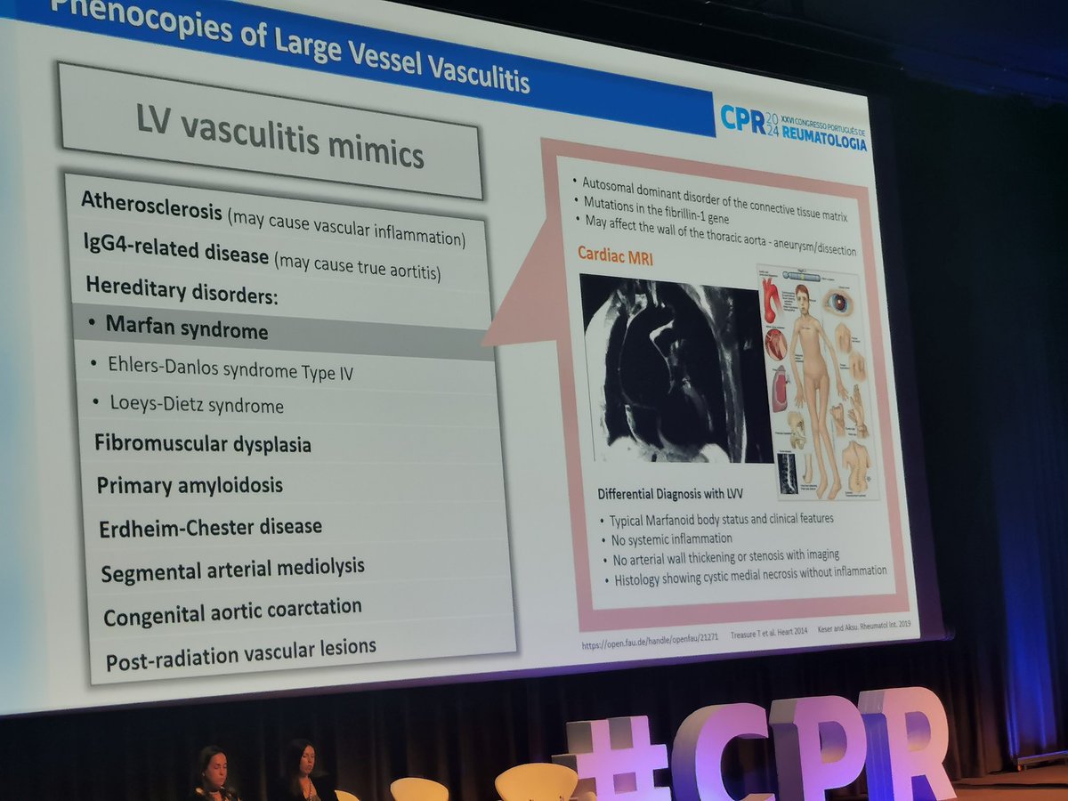 vitortexas's tweet photo. When to suspect large and medium vasculitis mimics. Excellent review from @cristinadbponte.
@LPCDR82 @ern_reconnet @_ERNRITA @vasculitides https://t.co/9DWukJFc6W