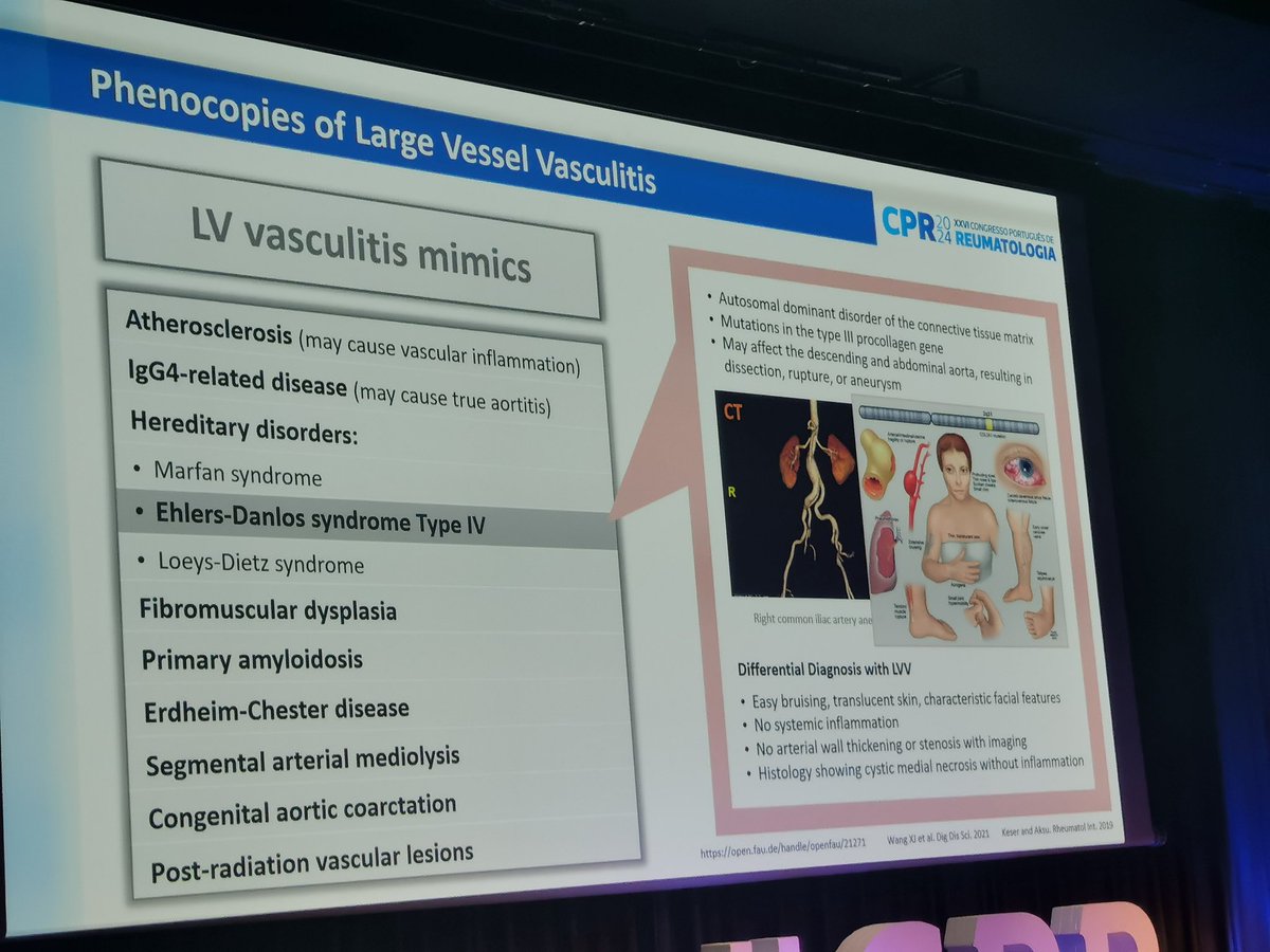 vitortexas's tweet photo. When to suspect large and medium vasculitis mimics. Excellent review from @cristinadbponte.
@LPCDR82 @ern_reconnet @_ERNRITA @vasculitides https://t.co/9DWukJFc6W