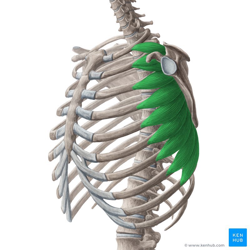 Nawaf_Nhar's tweet photo. إذا صار عندك مشكلة في عضلة Serratus anterior، سواء من شدّ، إجهاد أو إصابة، ممكن تحس بالأعراض التالية:

1. ألم في الجهة الأمامية أو الجانبية من الصدر.

2. صعوبة في رفع الذراع فوق مستوى الكتف.

3. ضعف في تثبيت لوح الكتف.

4. إحساس بطقطقة أو عدم استقرار في الكتف. https://t.co/NrvwRWPtwc
