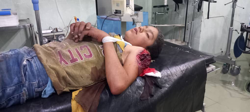 SDF_Syria's tweet photo. تحديث – استشهدت طفلة وأُصيب اثنان آخران بجروح بقصف مدفعي نفذته قوات الاحتلال التركي على قرية "بنية" بريف مدينة منبج.
اسم الشهيدة: فرح البرهو (١١ عام).
أسماء الجرحى: عبد الرحمن البرهو ١٣ عام.
سمير البرهو ٠٨ أعوام https://t.co/nQQGobkL8T
