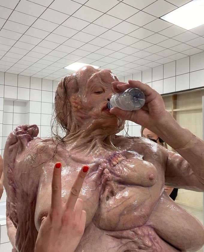 PatolocaMD's tweet photo. El teratoma que lleva 4 días en el laboratorio esperando que lo procese https://t.co/P8c2wH7AhH