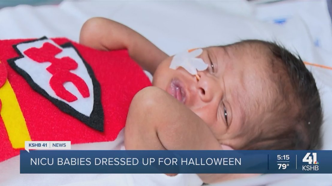 Saint Luke's (@saintlukeskc) on Twitter photo Our BOO-tiful NICU babies at Saint Luke's Hospital of Kansas City are celebrating their very first Halloween in style! These little cuties are all dressed up and ready to cast their spell of sweetness on us. 🎃
Watch the <a href="/KSHB41/">KSHB 41 News</a> story: heyor.ca/O4qjJD Our BOO-tiful NICU babies at Saint Luke's Hospital of Kansas City are celebrating their very first Halloween in style! These little cuties are all dressed up and ready to cast their spell of sweetness on us. 🎃
Watch the <a href="/KSHB41/">KSHB 41 News</a> story: heyor.ca/O4qjJD