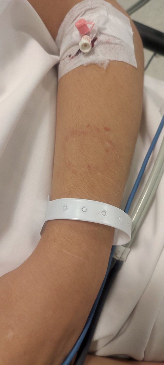 #SONDAKİKA | ODTÜ'de 20 PKK sempatizanı, bir ODTÜ'lü Türk milliyetçisi öğrenciye pusu kurdu.

Korkak PKK'lılar, sıkıştırdıkları gencin kolunu bacağını ısırdı. Genç, kuduz aşısı olacak.

20 PKK'lının 15'i, ODTÜ öğrencisi değil,15 saldırgan akademisyenlerce gizlice okula sokulmuş.