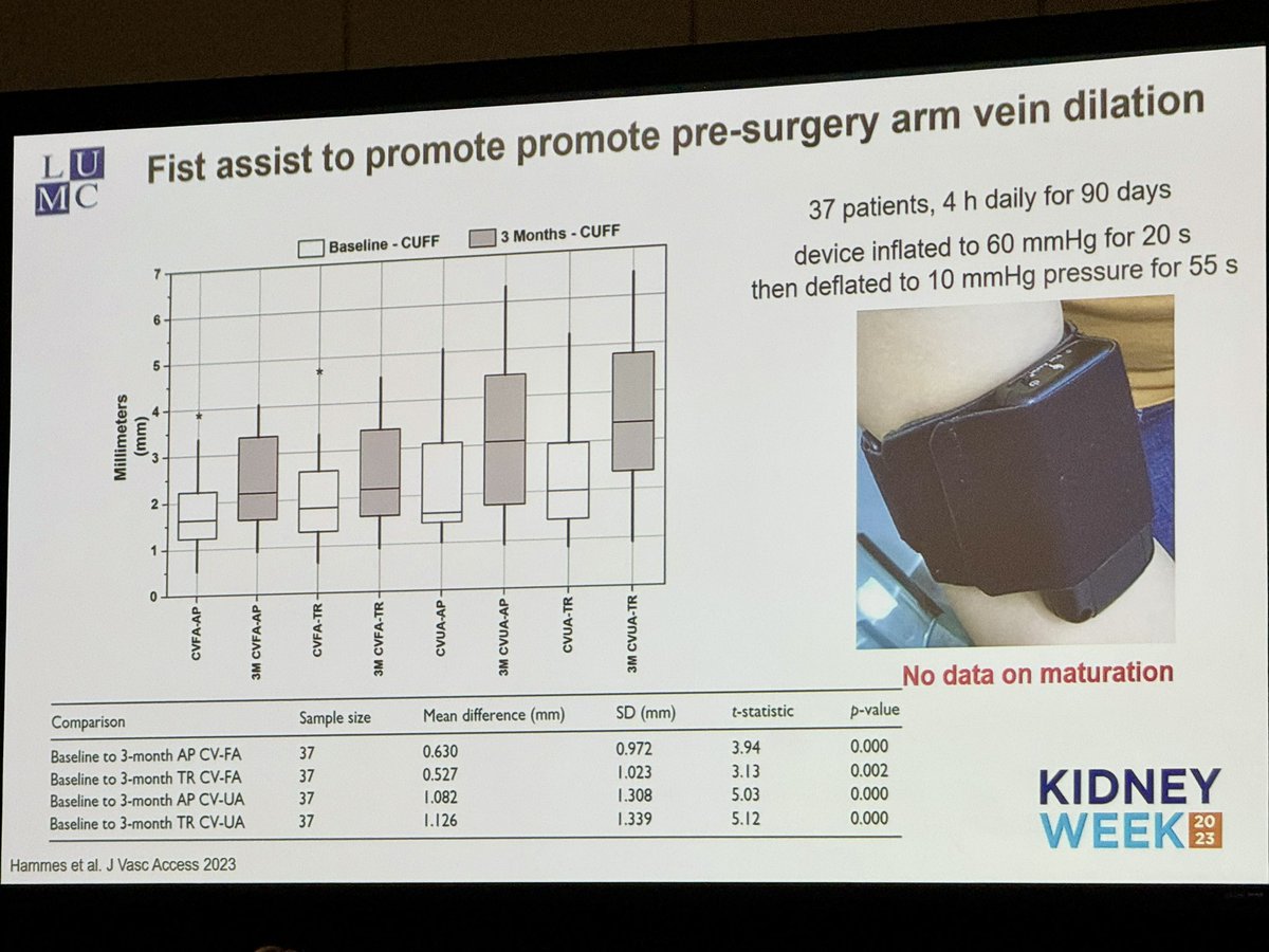 amitmahapatra's tweet photo. Kidney Week 24.10.24: Presentation on Novel Therapies to improve AVF Maturation by Joris Rotmans. Most techniques help in increase vein and artery diameter but doesn’t help in increased maturation or decreased use of of sec intervention. #KidneyWk2024 @drshyambansal @VijayKher8 https://t.co/Irq7G5SHy9