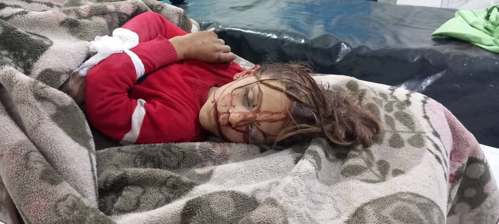Jamal_Bali7's tweet photo. Update
One little girl martyred and two other children injured due to artillery shelling by the Turkish occupation forces on their house in Benyah village, Manbij. The  martyrd girl's name is Farah al-Barhow (11 years old), and the names of other injured children are Abdulrahman al-Barhow (13 years old) and Sameer al-Barhow (8 years old).

SDF Media Center