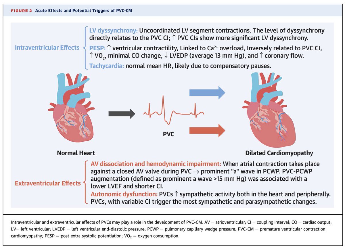 DrWillWatson's tweet photo. One remarkable thing about this (clinically really useful) article is how little we know about the pathophysiology of tachycardia mediated CM. Reduced calcium transients and fibrosis seem to play a role.
https://t.co/SDQRItqsLx https://t.co/wwZwDDH9k9