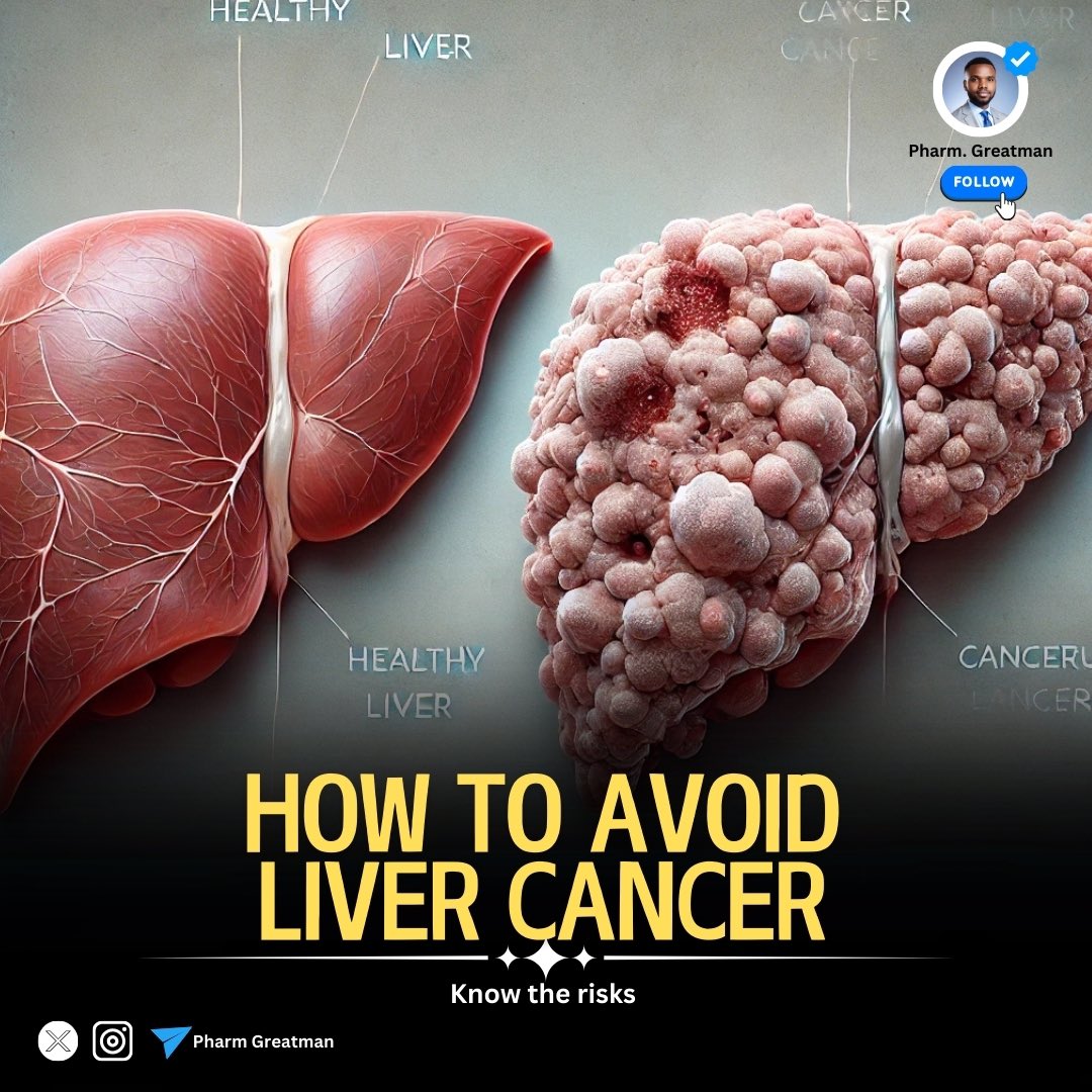 LIVER CANCER

Liver cancer is on the rise, but knowing your risks can help protect your health! 

From hepatitis to lifestyle habits, understanding this complex disease could save lives. 

Understand the basics, symptoms, and ways to reduce your risk.

A thread