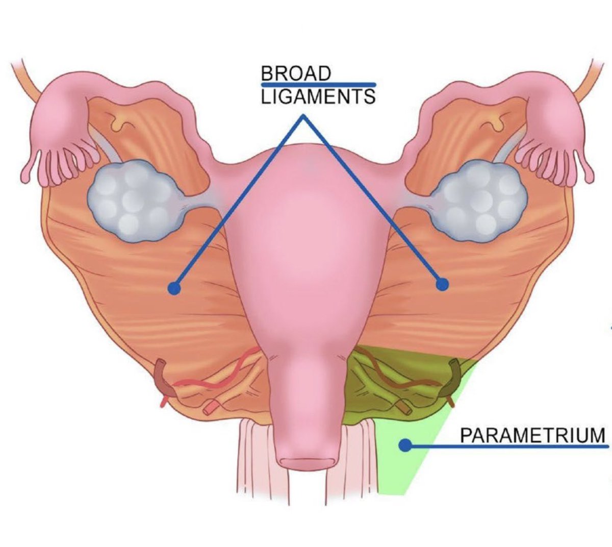 luciana@chamie.com.br (@lucianachamiec1) on Twitter photo Lateral pelvic compartments- Broad ligaments, parametrium, paracolpium Abdominal Radiology doi.org/10.1007/s00261… <a href="/Abdominal_Rad/">Abdominal Radiology</a> <a href="/SocietyAbdRad/">Society of Abdominal Radiology | SAR</a> Lateral pelvic compartments- Broad ligaments, parametrium, paracolpium Abdominal Radiology doi.org/10.1007/s00261… <a href="/Abdominal_Rad/">Abdominal Radiology</a> <a href="/SocietyAbdRad/">Society of Abdominal Radiology | SAR</a>