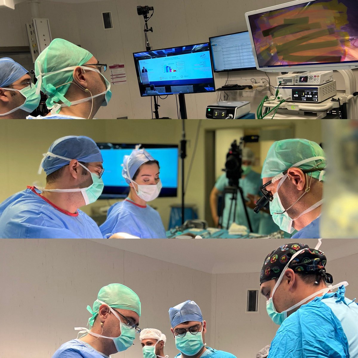 #6thkidneytransplantationcourse için #canlıcerrahi #laparaskopikdonörnefrektomi ameliyatı ve #böbreknakli ameliyatı gerçekleştirdik. We performed live surgery and broadcast for #6thkidneytransplantationcourse <a href="/MemorialSaglik/">Memorial Sağlık</a>  <a href="/organnaklivakfi/">Türkiye Organ Nakli Vakfı</a>