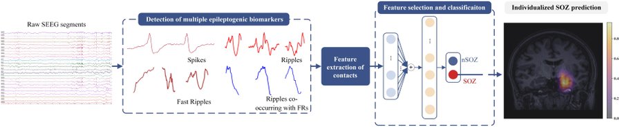 MDPIEngineering's tweet image. 🌟Excited to share the Editor’s Choice Paper, Volume 9 Issue 12: Automatic Localization of Seizure Onset Zone Based on Multi-Epileptogenic Biomarkers Analysis of Single-Contact from Interictal SEEG📷mdpi.com/2306-5354/9/12… #electroencephalogram #deep_learning #signal_processing