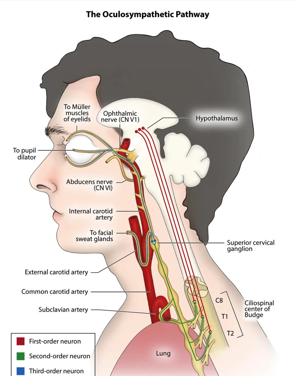 NeuroWalid's tweet photo. The occulo-sympathetic pathway. 
#neurotip #Neuroanatomy https://t.co/ZNn6nZJYGe