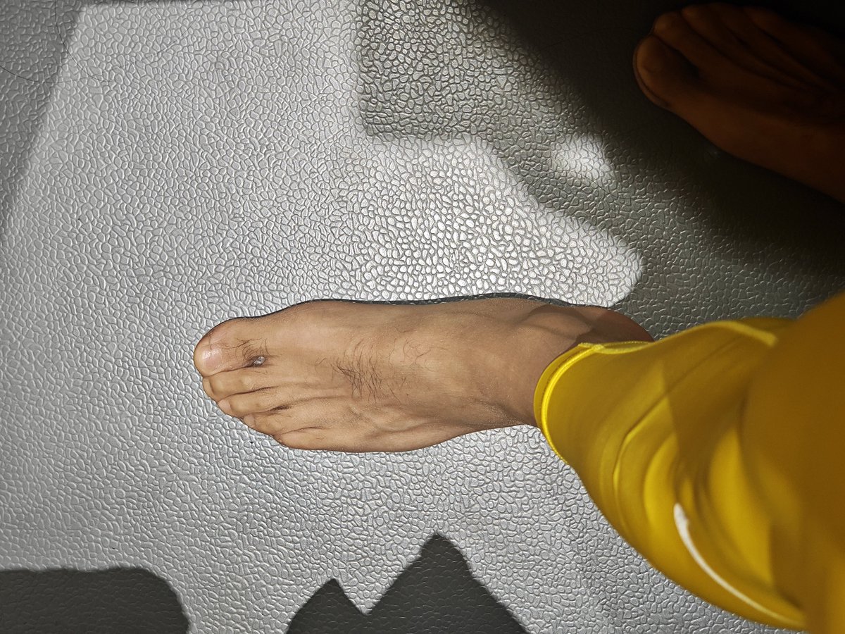 肌肉丝 tweet media