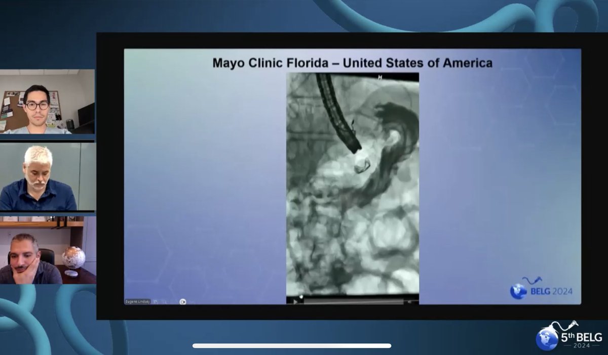 Bariatric Endoscopy Live Global (@bariatriclive) on Twitter photo 18th live case 🇺🇸
💻 We are on line with <a href="/VKumbhari/">Vivek Kumbhari</a> <a href="/VictoriaGomezMD/">Victoria Gomez</a> <a href="/DBadurdeen/">Dilhana Badurdeen</a> 🇺🇸
🔺#gpoem for #sleeve stenosis 🔻
👉🏻 bariatricendoscopylive.com 18th live case 🇺🇸
💻 We are on line with <a href="/VKumbhari/">Vivek Kumbhari</a> <a href="/VictoriaGomezMD/">Victoria Gomez</a> <a href="/DBadurdeen/">Dilhana Badurdeen</a> 🇺🇸
🔺#gpoem for #sleeve stenosis 🔻
👉🏻 bariatricendoscopylive.com