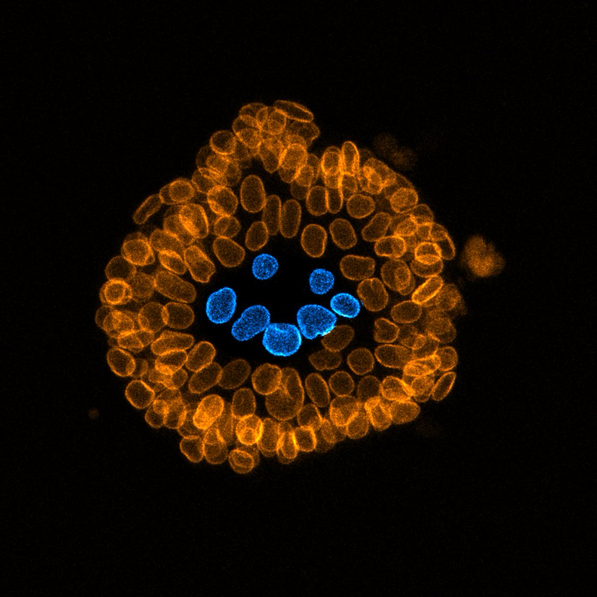 👻🔬 Who knew stem cells could get into the #Halloween spirit? 
This #FluorescenceFriday , our cells are serving some serious spooky pumpkin vibes! 🎃✨ 
Science + Spooky Season = Perfection! #PumpkinSpiceCells