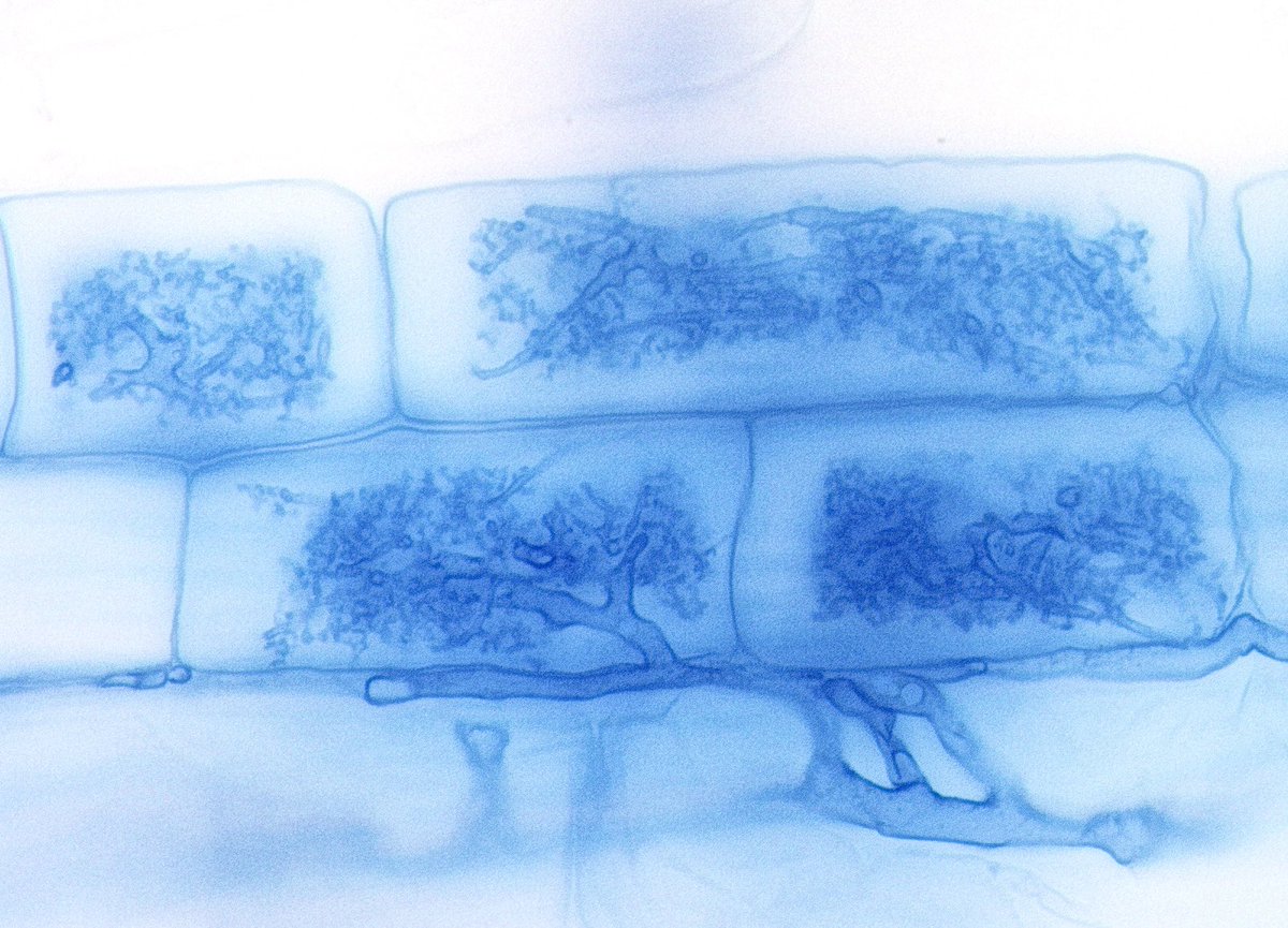 アーバスキュラー菌根菌の樹枝状体。
その精緻な菌糸構造には機能美のようなものを感じずにはいられないのです。
自然の営みは美しい。
