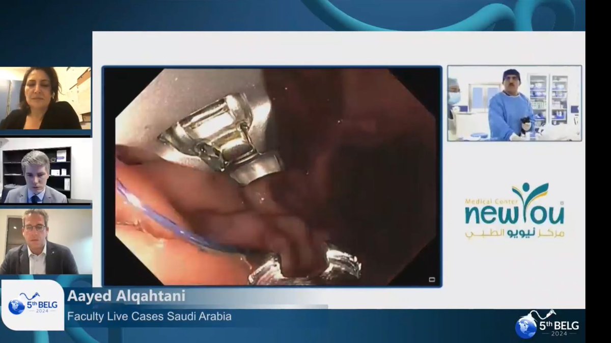 Bariatric Endoscopy Live Global (@bariatriclive) on Twitter photo 8th live case!
ESG after ESG for weight regain, amazing case perform by <a href="/dralqahtani1/">الدكتور عائض القحطاني Prof Aayed Alqahtani</a> 🇸🇦
Check it using the link after registration belg.tbr.com.br 8th live case!
ESG after ESG for weight regain, amazing case perform by <a href="/dralqahtani1/">الدكتور عائض القحطاني Prof Aayed Alqahtani</a> 🇸🇦
Check it using the link after registration belg.tbr.com.br