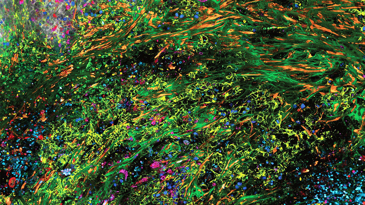 SpectraPlex for STELLARIS: the new 3D high-multiplex solution for spatial discoveries! Access 3D multiplexing across scales in one go. Gain functional descriptions of immune cells, cancer fingerprints &amp; structural hallmarks in tissues.fcld.ly/gn7bmxu #DanaherNews
