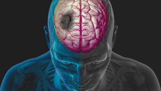 Hablemos de los 8 esenciales para prevenir el infarto cerebral, una condición que diariamente cobra vidas en todo el mundo. Basado en recomendaciones de la AHA 2024. 

Abro hilo 🧵