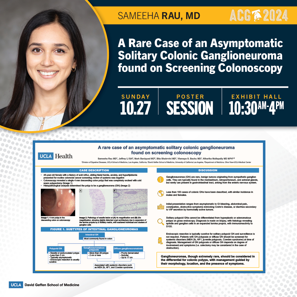 #ACG2024 Poster! A Rare Case of an Asymptomatic Solitary Colonic Ganglioneuroma Found on Screening Colonoscopy

👤Sameeha Rau, MD (<a href="/sameeharau/">Sameeha Rau</a>)
👥Jeff Li Mark Baniqued <a href="/BitaShahrvini/">Bita Shahrvini</a> <a href="/VismayaBachuMD/">Vismaya Bachu, MD</a> <a href="/MallepallyRika/">Rika Mallepally MD MPH</a>
🗓️Sunday, October 27, Exhibit Hall, 10:30am-4pm