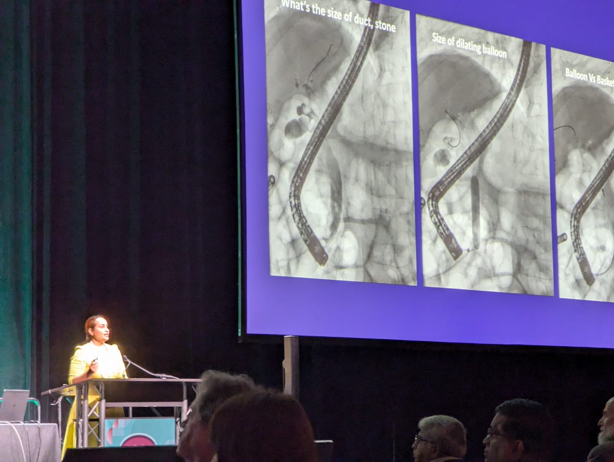 Mohamed Abdallah, MD (@mabdallahmd) on Twitter photo Fantastic talk about the removal of large CBD stones by the great <a href="/ChahalPrabhleen/">Prabhleen Chahal MD,MASGE,FACG</a> <a href="/ASGEendoscopy/">ASGE GI Endoscopy</a> course <a href="/AmCollegeGastro/">ACG</a> #ACG Fantastic talk about the removal of large CBD stones by the great <a href="/ChahalPrabhleen/">Prabhleen Chahal MD,MASGE,FACG</a> <a href="/ASGEendoscopy/">ASGE GI Endoscopy</a> course <a href="/AmCollegeGastro/">ACG</a> #ACG