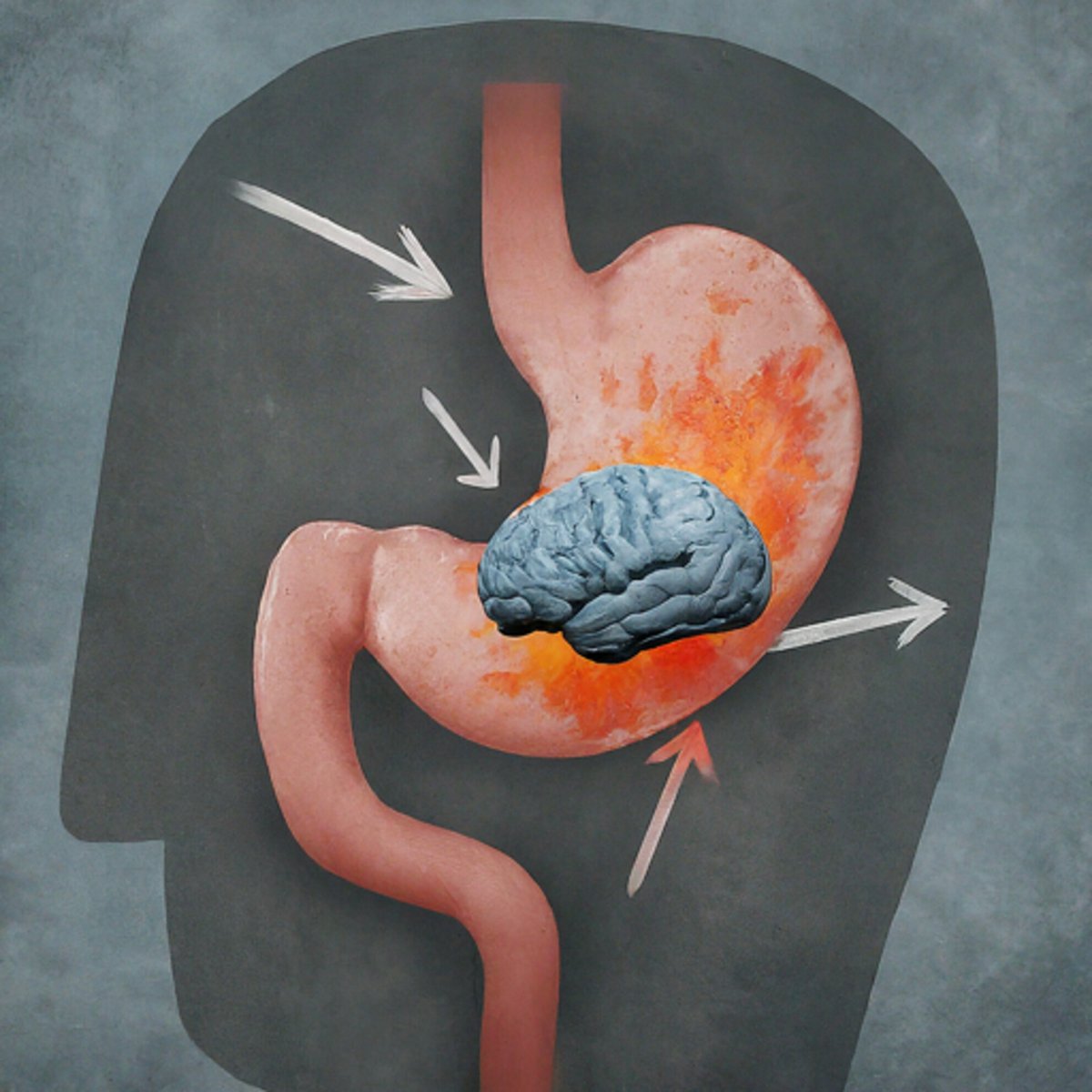 Neurogastro & Motil (@ngmjournal) on Twitter photo 🆕🔥Diagnostic classification systems for #disorders of #gut-#brain interaction should include #Psychological symptoms‼️
❇️Inclusion of #psychological symptoms would alter how individuals group #clinically👏
👉 onlinelibrary.wiley.com/doi/10.1111/nm…
<a href="/ANMSociety/">ANMS</a> <a href="/esnm_eu/">ESNM.eu</a> #DGBI <a href="/RomeGastroPsych/">Rome PsychoGastroenterology</a> 🆕🔥Diagnostic classification systems for #disorders of #gut-#brain interaction should include #Psychological symptoms‼️
❇️Inclusion of #psychological symptoms would alter how individuals group #clinically👏
👉 onlinelibrary.wiley.com/doi/10.1111/nm…
<a href="/ANMSociety/">ANMS</a> <a href="/esnm_eu/">ESNM.eu</a> #DGBI <a href="/RomeGastroPsych/">Rome PsychoGastroenterology</a>