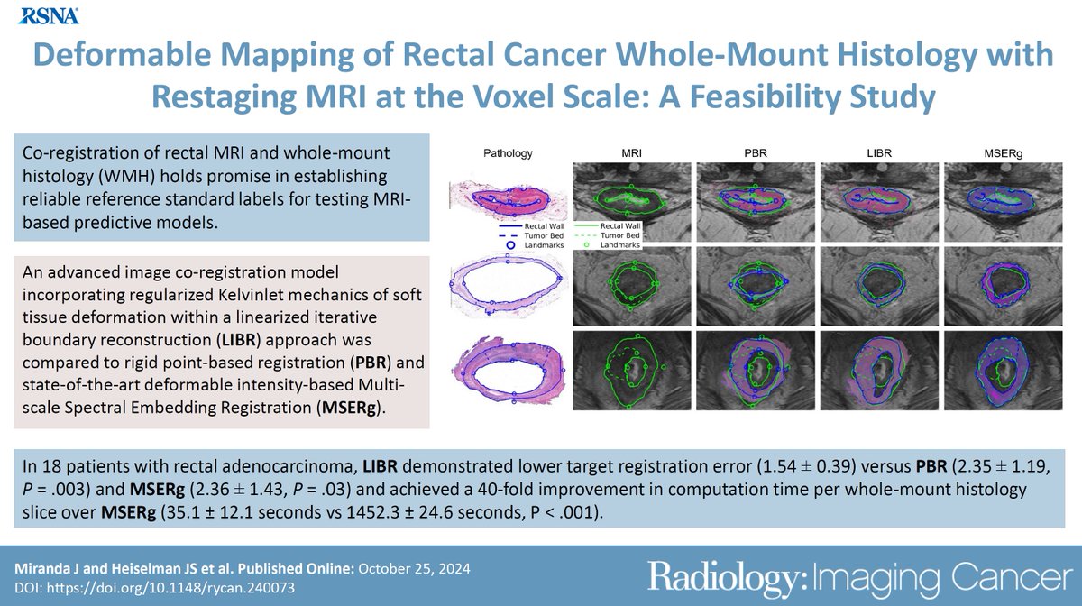 RadIC_Editor (@radic_editor) on Twitter photo 🔥 Hot off the press from Radiology: Imaging Cancer -
"Deformable Mapping of Rectal Cancer Whole-Mount Histology with Restaging MRI at Voxel Scale: A Feasibility Study" by Miranda et al.
Full Article: doi.org/10.1148/rycan.…
#ImagingCancer #Cancer <a href="/luker_md/">Gary D Luker MD</a> 🔥 Hot off the press from Radiology: Imaging Cancer -
"Deformable Mapping of Rectal Cancer Whole-Mount Histology with Restaging MRI at Voxel Scale: A Feasibility Study" by Miranda et al.
Full Article: doi.org/10.1148/rycan.…
#ImagingCancer #Cancer <a href="/luker_md/">Gary D Luker MD</a>