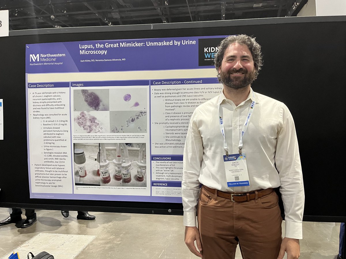 cybele ghossein (@cybeleg1) on Twitter photo Who says renal fellows are no longer using urine microscopy ? Here is our super star fellow @KisleysKidneys with his abstract about the diagnosis of acute GN in an ICU patient with AKI by using urine microscopy. <a href="/NU_Nephrology/">Northwestern Kidney</a> <a href="/ASNKidney/">American Society of Nephrology</a> #kidneyweek2024 Who says renal fellows are no longer using urine microscopy ? Here is our super star fellow @KisleysKidneys with his abstract about the diagnosis of acute GN in an ICU patient with AKI by using urine microscopy. <a href="/NU_Nephrology/">Northwestern Kidney</a> <a href="/ASNKidney/">American Society of Nephrology</a> #kidneyweek2024