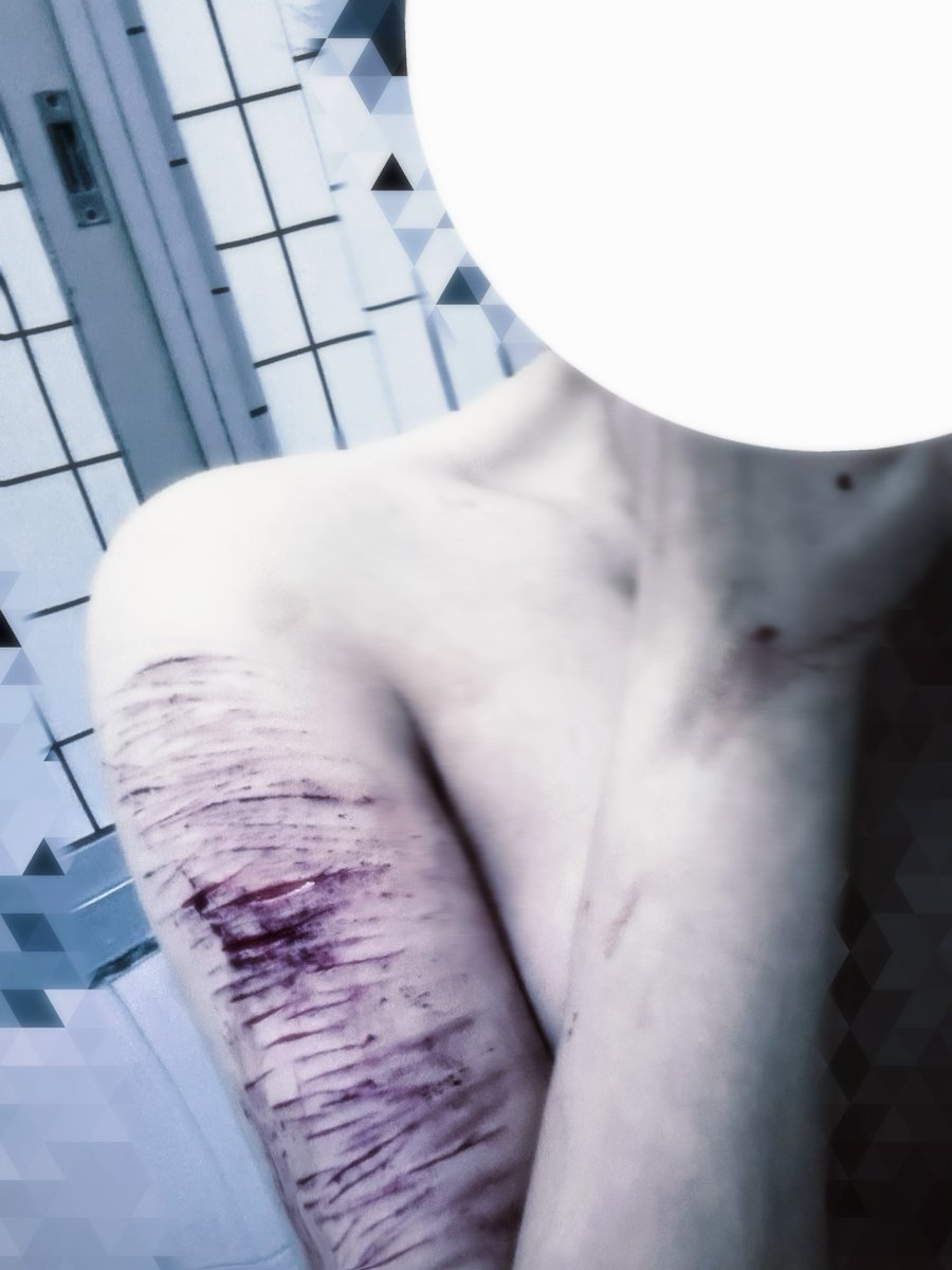 #selfharm
  #自残