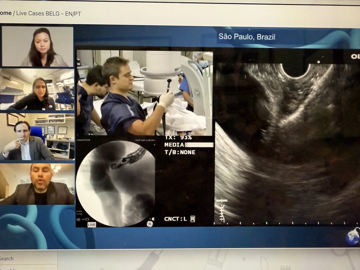 Rashmi Advani, MD, ABOM (@advanirashmimd) on Twitter photo 🚨 High-level set of cases! Happening right now!
Fun co-moderating with colleagues/friends <a href="/RobertoSimonsMD/">Roberto Simons-Linares, MD</a> <a href="/JennPhanMD/">Jenn Phan MD</a> <a href="/RobTrasolini/">Roberto Trasolini</a> on amazing cases performed by <a href="/DrMcGowanMD/">Christopher McGowan, MD</a> <a href="/shailsingh/">Shailendra Singh</a> <a href="/DiogoPhd/">Diogo Moura</a> <a href="/MetabolicEndo/">Chris Thompson, MD</a>
Go <a href="/BariatricLive/">Bariatric Endoscopy Live Global</a> !
#Endobariatric #Bariatricendoscopy 🚨 High-level set of cases! Happening right now!
Fun co-moderating with colleagues/friends <a href="/RobertoSimonsMD/">Roberto Simons-Linares, MD</a> <a href="/JennPhanMD/">Jenn Phan MD</a> <a href="/RobTrasolini/">Roberto Trasolini</a> on amazing cases performed by <a href="/DrMcGowanMD/">Christopher McGowan, MD</a> <a href="/shailsingh/">Shailendra Singh</a> <a href="/DiogoPhd/">Diogo Moura</a> <a href="/MetabolicEndo/">Chris Thompson, MD</a>
Go <a href="/BariatricLive/">Bariatric Endoscopy Live Global</a> !
#Endobariatric #Bariatricendoscopy