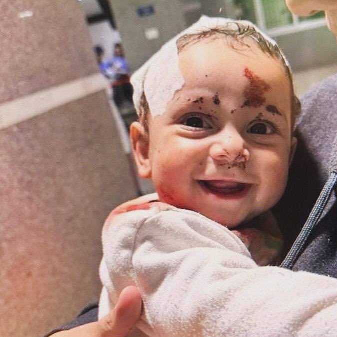 Injured little Lebanese smiles through his wounds sustained ...