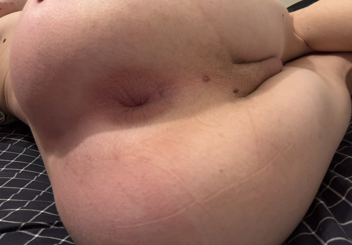 ifpass_gard16's tweet photo. Tout seul à rien faire ce week end sur Lyon, quelqu’un pour me tenir compagnie ? Ça fait trop longtemps que j���ai pas baisé je suis en manque 🥵😭 venez dm les lyonnais 😝
#gaylyon #gayporn #gayvideos #plancul #bottom #imberbe #feet #teen #twink #whore #gay https://t.co/f2wkMatEbV