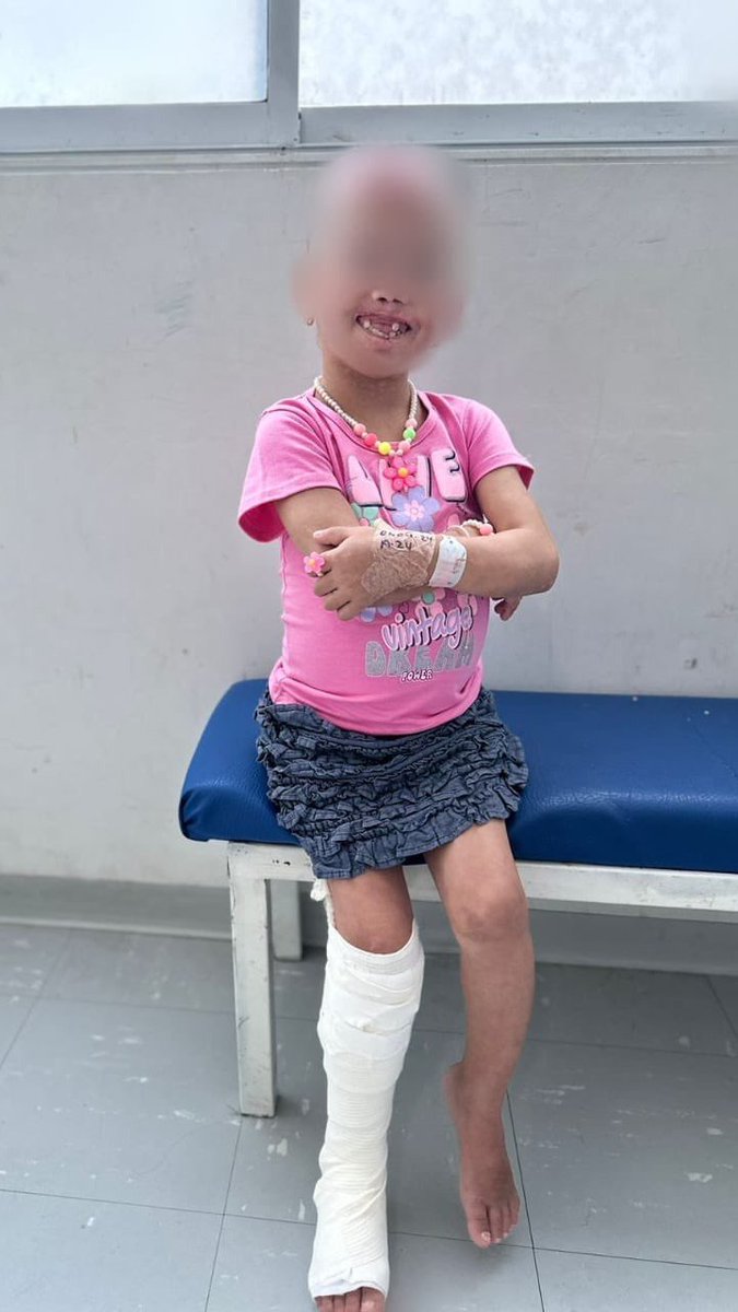 ColombiaOscura's tweet image. #MALDITOS 😡 Caso aberrante de abuso infantil en Sabanalarga, Atlántico: una niña de solo 7 años fue sometida a torturas inimaginables por su abuela materna y su pareja.

🚨 ÚNETE 👉 t.me/colombiaoscura…

Las autoridades revelaron que la pequeña era víctima de maltrato físico…