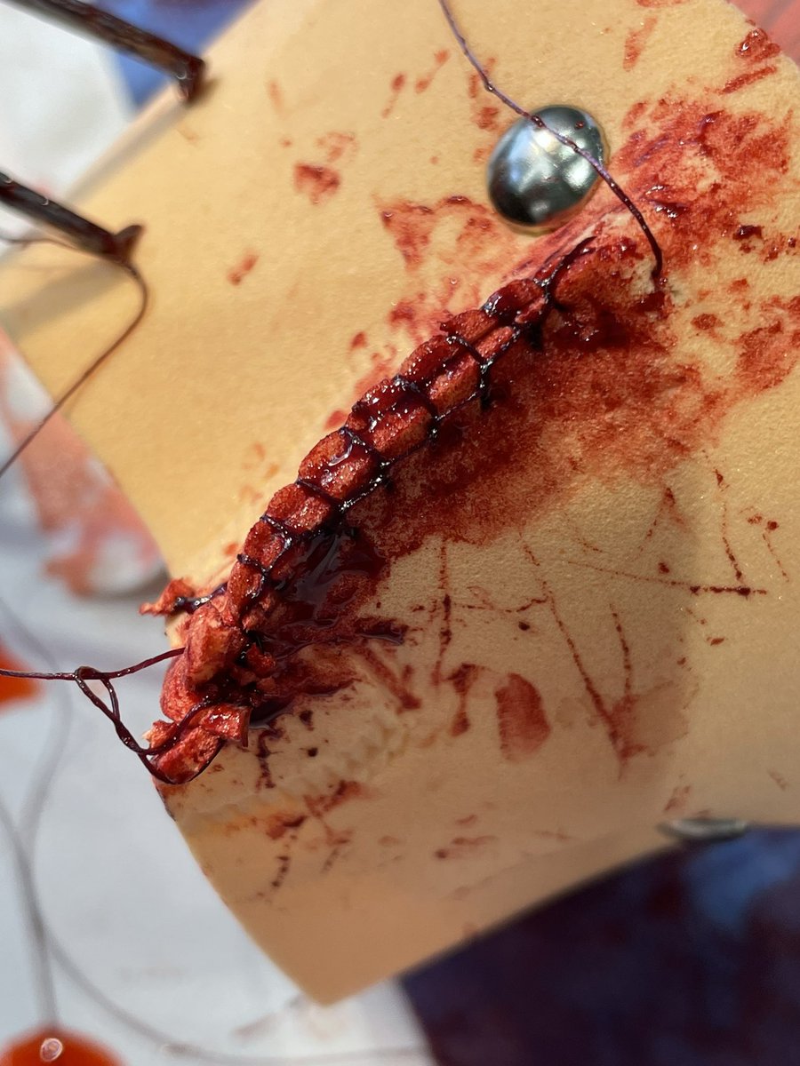 CATAVAORMD's tweet image. 💡 Hoy en el SkillLab de Ginecología y Obstetricia en @unisabana, nuestros estudiantes entrenaron en control de hemorragia obstétrica usando modelos de bajo costo ymateriales reciclados: ¡innovación frugal para una educación de calidad! #SimulaciónClínica #EducaciónMédica #obgyn