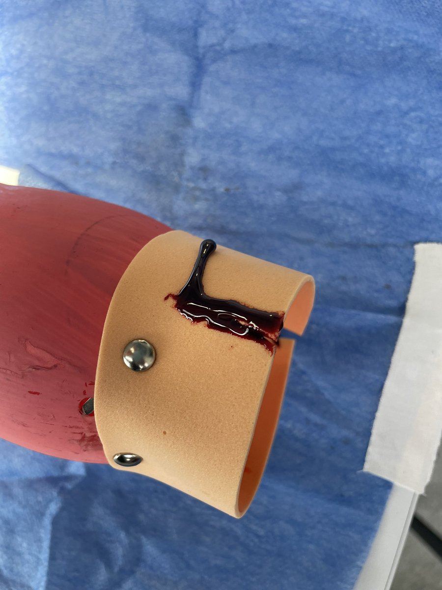 CATAVAORMD's tweet image. 💡 Hoy en el SkillLab de Ginecología y Obstetricia en @unisabana, nuestros estudiantes entrenaron en control de hemorragia obstétrica usando modelos de bajo costo ymateriales reciclados: ¡innovación frugal para una educación de calidad! #SimulaciónClínica #EducaciónMédica #obgyn