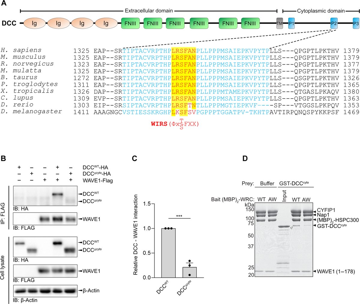 Penn Medicine CSO (@pennmedcso) on Twitter photo A human DCC variant causing mirror movement disorder reveals that the WAVE regulatory complex mediates axon guidance by netrin-1–DCC ft. <a href="/kchau91/">Karina Chaudhari</a>, Yixin Zang, Sarah Gagnon & <a href="/BashawLab/">Bashaw Lab</a> (<a href="/PennMINS/">Mahoney Institute for Neurosciences @UPenn</a>) <a href="/PennNGG/">Penn NGG</a> <a href="/scisignal/">Science Signaling</a> tinyurl.com/muy6y235 A human DCC variant causing mirror movement disorder reveals that the WAVE regulatory complex mediates axon guidance by netrin-1–DCC ft. <a href="/kchau91/">Karina Chaudhari</a>, Yixin Zang, Sarah Gagnon & <a href="/BashawLab/">Bashaw Lab</a> (<a href="/PennMINS/">Mahoney Institute for Neurosciences @UPenn</a>) <a href="/PennNGG/">Penn NGG</a> <a href="/scisignal/">Science Signaling</a> tinyurl.com/muy6y235