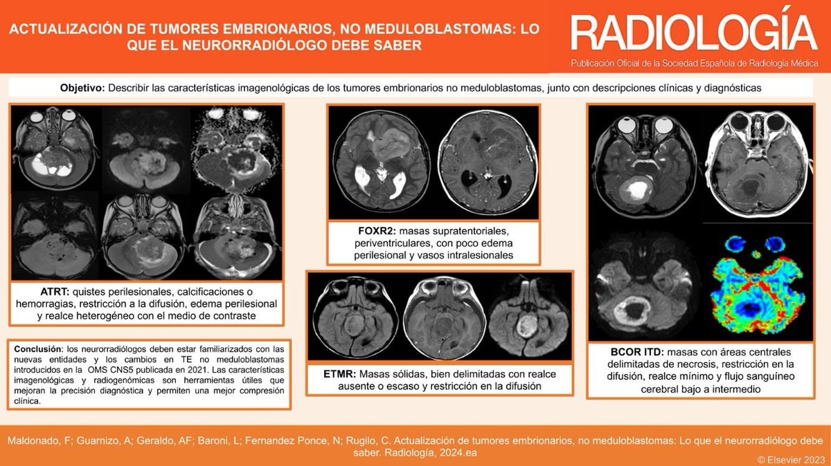 Lo que el radiólogo debe saber sobre los tumores embrionarios, no meduloblastomas: 
doi.org/10.1016/j.rx.2…