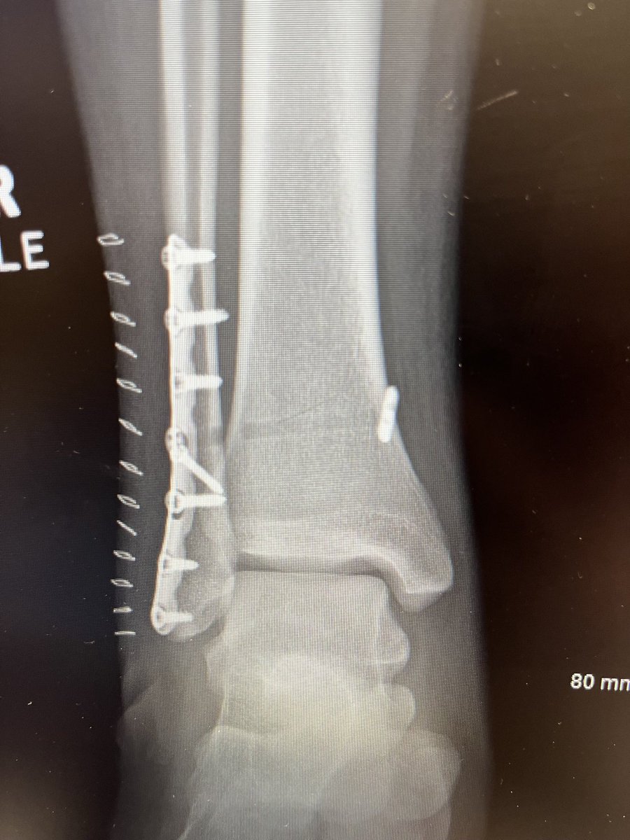 William Moore tweet media