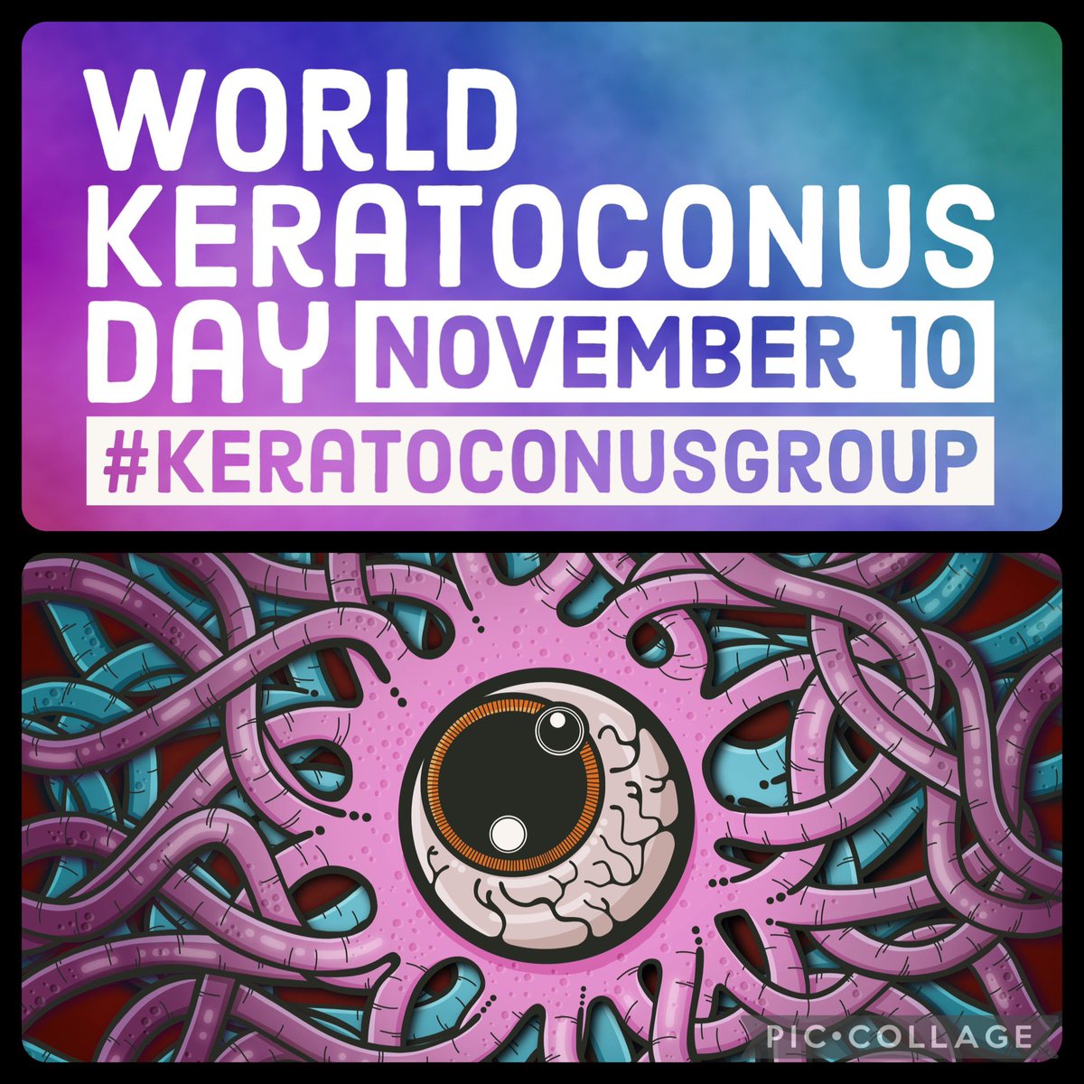 Ozfiz_'s tweet image. Being an artist with keratoconus means seeing the world a little differently, but thanks to treatments, my creative vision is still going strong! 🎨👁️ #Keratoconus #KeratoconusGroup #ArtistLife #worldkcday