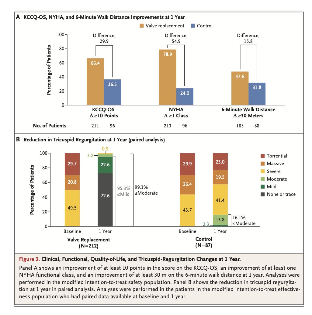 🫀TRISCEND II trial shows transcatheter tricuspid-valve replacement (TTVR) with OMT significantly improves symptoms and quality of life at 1 year for patients with severe tricuspid regurgitation compared to OMT alone, though with higher rates of bleeding and pacemaker use.