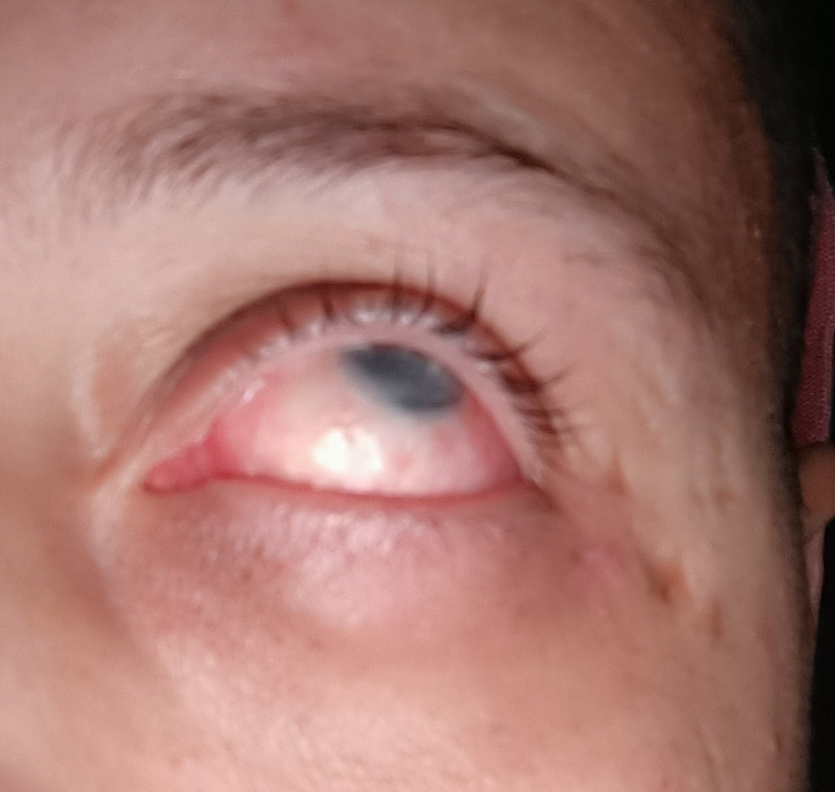 I CAN'T TAKE THE PAIN!
This is the third time i woke up from severe pain in my eye tonight.

If u care, Please Pray for me😭
gofund.me/e72769fc