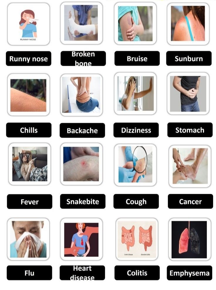 knowiiiedge's tweet photo. Disease name https://t.co/k5ET4lu8Rh