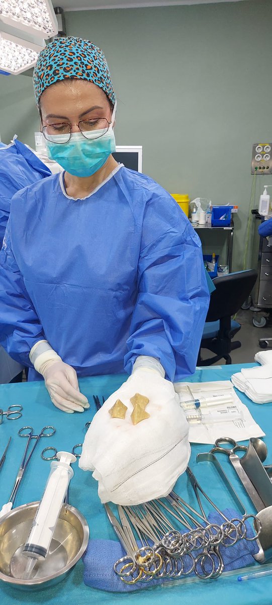 Hoy nueva cirugía conjunta con el Servicio de urología pediátrica. Remodelación de Mitrofanoff por fallo de continencia en paciente con ampliación vesical por mielomeningicele. Siempre un placer contar con <a href="/rromeronline/">Rosa Romero</a> <a href="/UronefroHUVR/">@Uro-NefroHUVR</a>