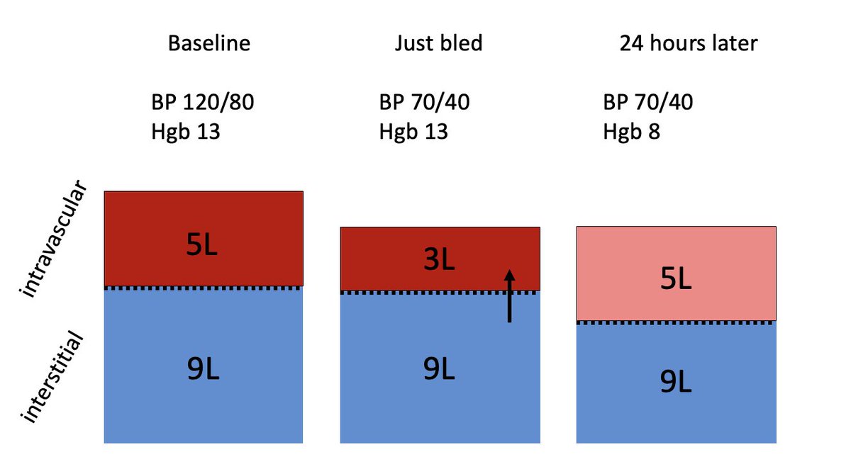 If I’m having massive blood loss, why is my hgb 13 mg/dL?

Cause it’s a concentration! Immediately after blood loss, amount hgb per volume blood is the same. There's just less blood.

BP 70/40, hgb 13

It takes time to reconstitute serum volume and "dilute down" the hgb/dL.

2/8