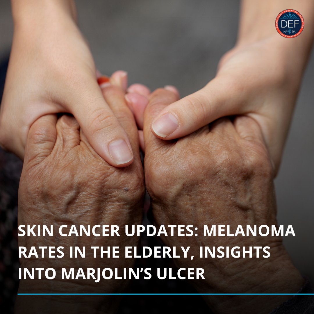 DermNPPA's tweet photo. New data shows a 2.8-fold rise in cutaneous malignant melanoma (CMM) among elderly Americans. A separate study on Marjolin’s ulcer (MU) reveals changes in keratinocytes that promote tumor growth. Insights could aid future treatments. #skincancer #melanoma https://t.co/H1kQr2QNds