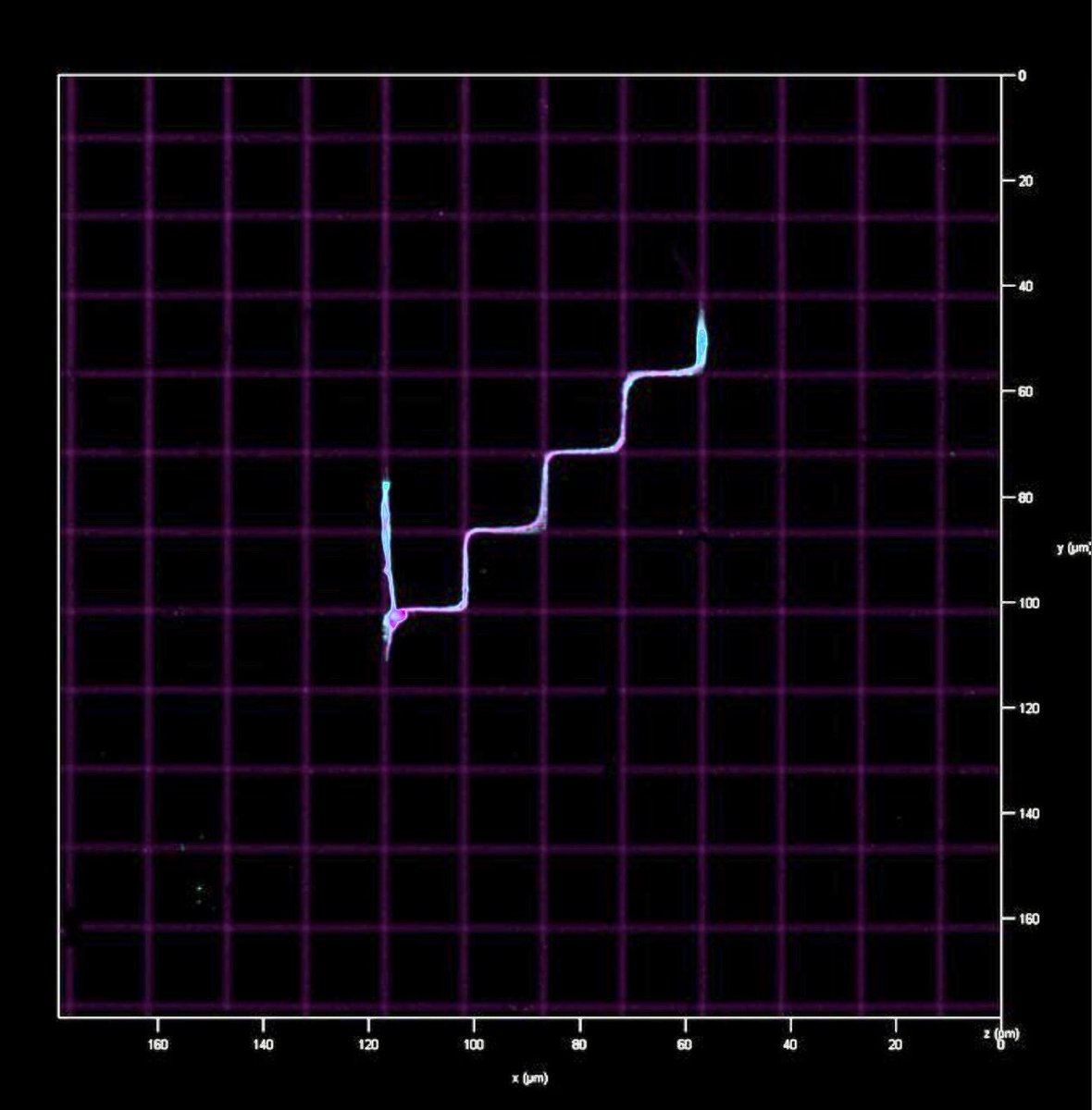 Tabdanov's tweet image. Human breast #cancer cell, i.e.,  #adenocarcinoma cell (MDA-MB-231), loses structural integrity and generates migratory cytoplasts. The micro-cytoplasts migrate using #dynein-generated forces in the #microtubule network, and are independent of #myosin contractility.