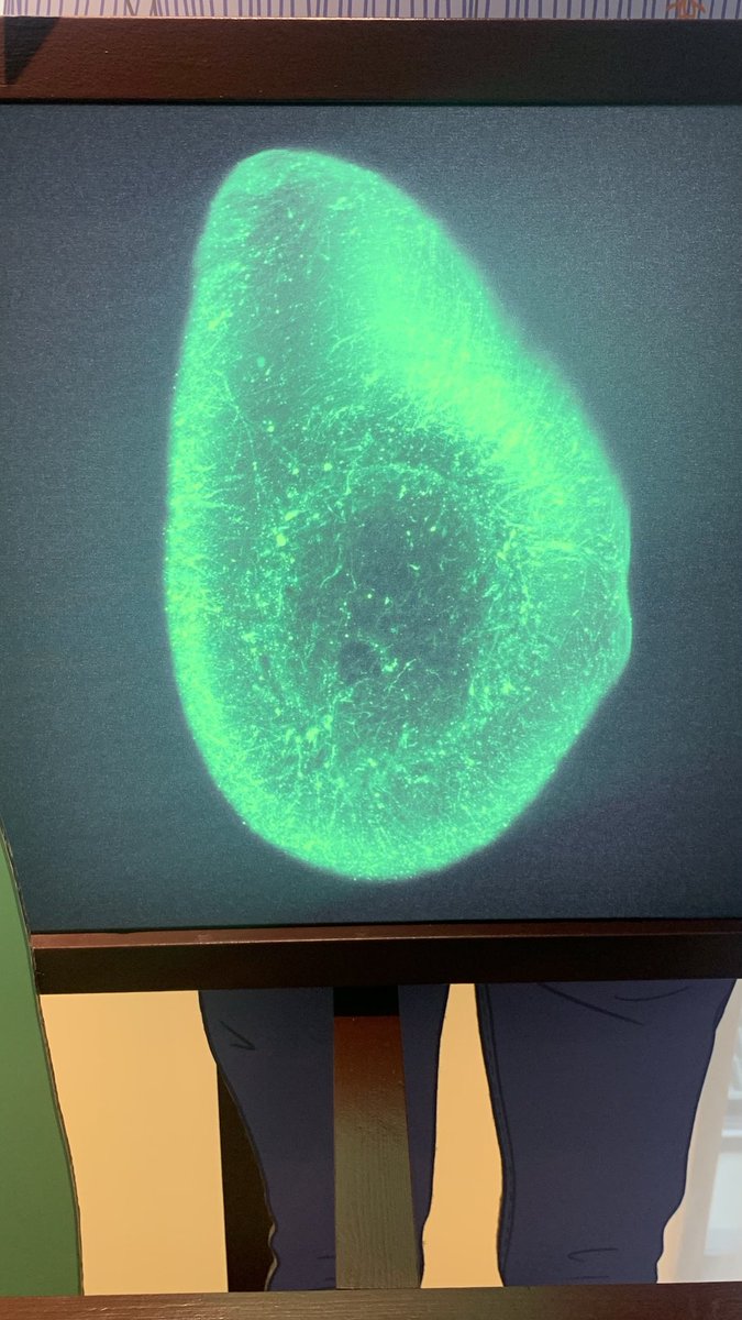 Alison Bowyer ๐ (@alisonbowyer) on Twitter photo #Green from the incredible and fabulously accessible Hello Brain โฆ<a href="/TheCrick/">The Francis Crick Institute</a>โฉ #Museum30 #Green from the incredible and fabulously accessible Hello Brain โฆ<a href="/TheCrick/">The Francis Crick Institute</a>โฉ #Museum30