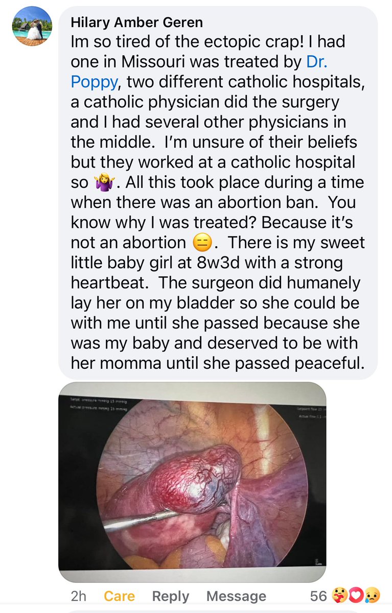 drpoppyBHRT's tweet image. Patient of mine with an ectopic who gave permission for her story to be shared.